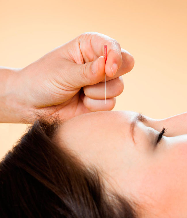 Schädelakupunktur nach Dr. T. Yamamoto